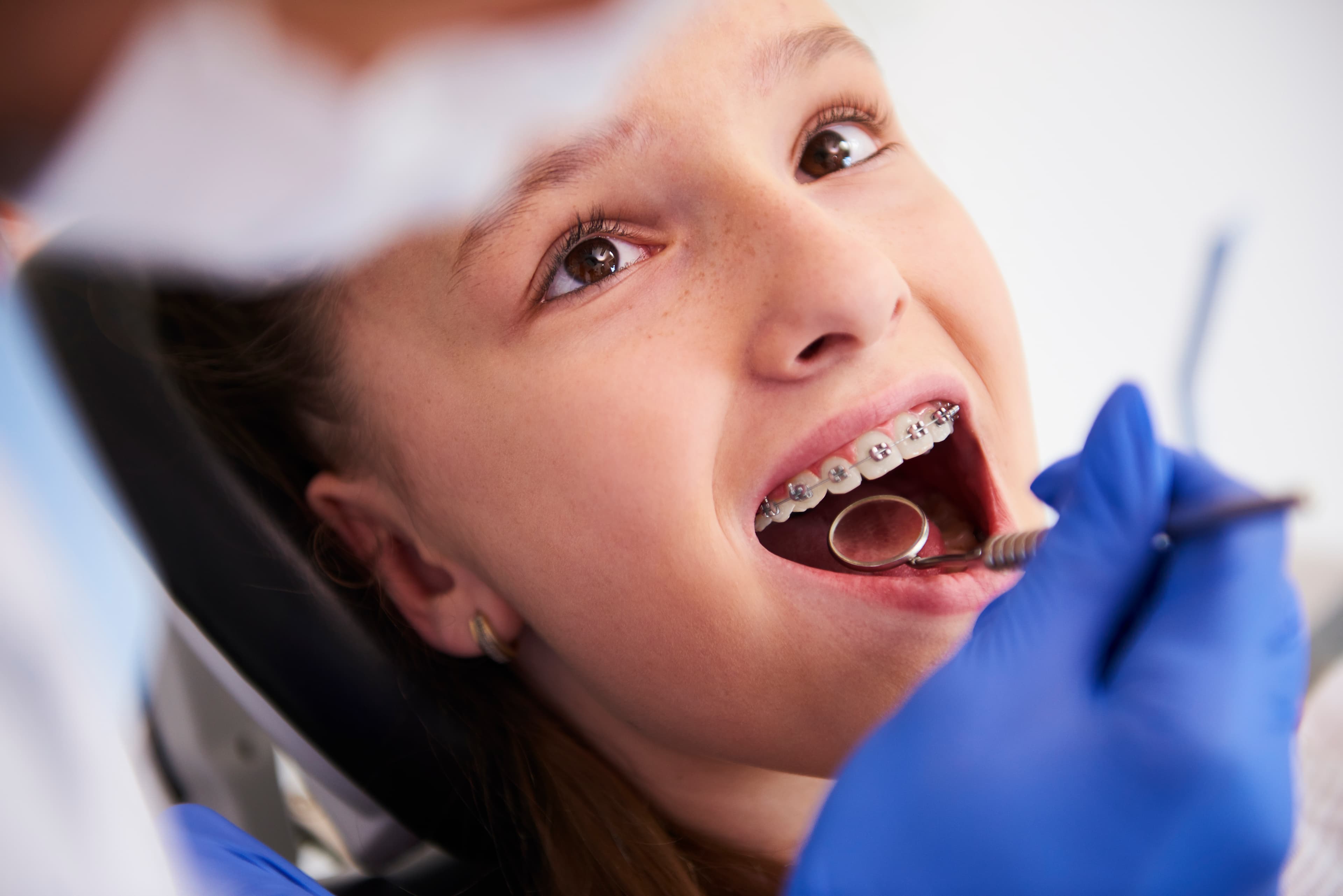 Braces assessment service
